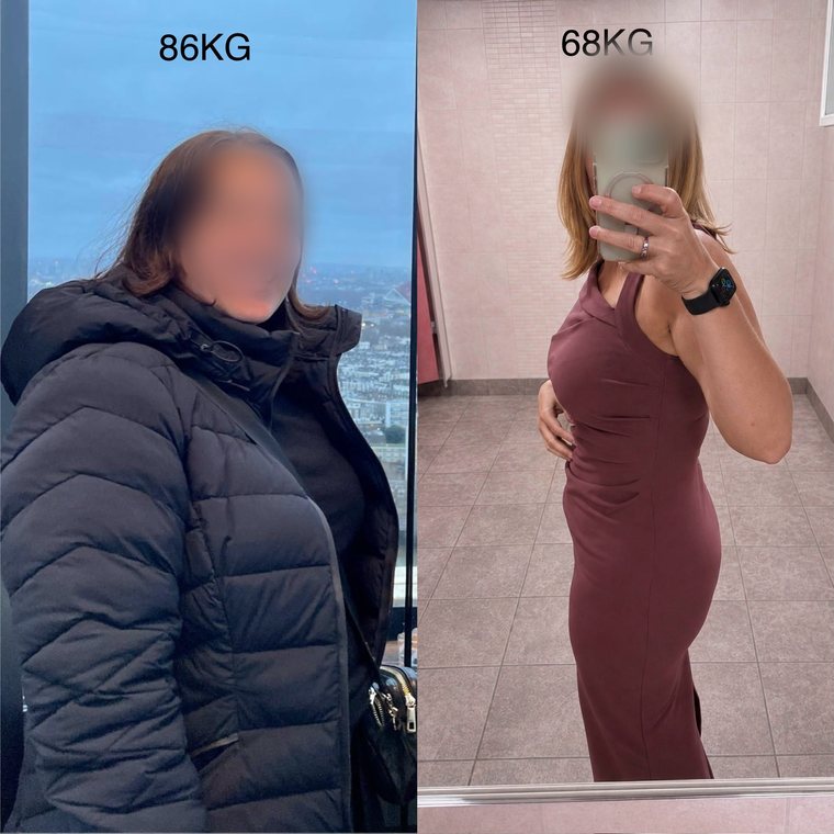 Anonymous client before and after: 86kg in a winter coat, 68kg in a fitted dress, faces blurred for privacy